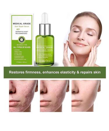 Goopgen Advanced Scar Repair Serum - Medical Grade Scar Removal for All Types of Scars (2PCS) - Buy Online on GoSupps.com