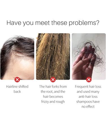 Organic Hair Growth Oil - Rice Water For Hair Growth | For Hair Growth Repairs Essential Oil For Damaged Growth - Buy Online on GoSupps.com