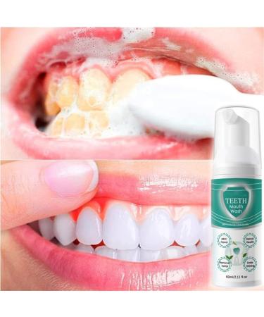 New Teeth Whitening Mouthwash - 2024 | 360 Gum Health Care & Deep Cleaning Foam (3 PCs) - Buy Online on GoSupps.com