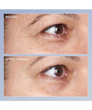 Perricone MD High Potency Triple Retinol Renewal Eye Serum 0.5 fl. oz. - Buy Online on GoSupps.com