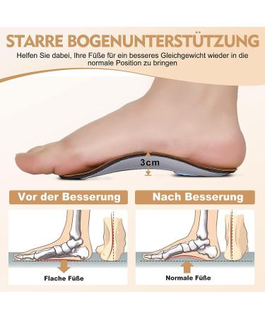 Orthotic Arch Support Insoles for Men/Women XL - Plantar Fasciitis Relief, High Arch Support Inserts for Flat Feet, Over-Pronation - Heel Cushion for Running/Walking - Size XL (Men 11.5-13, Women 13.5-15) - Buy Online on GoSupps.com