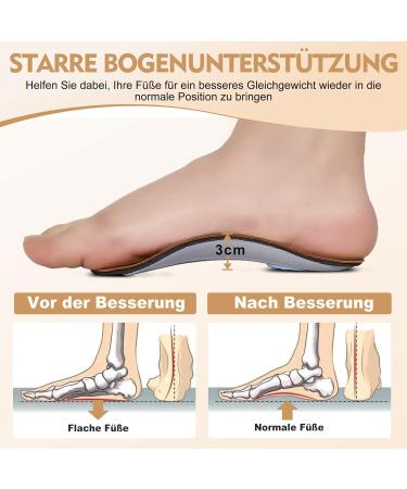 3/4 Length Orthotic Insoles for Plantar Fasciitis | Cushioning Support for Flat Feet | Shoe Inserts for Men & Women - EU Size 35/36 - Buy Online on GoSupps.com