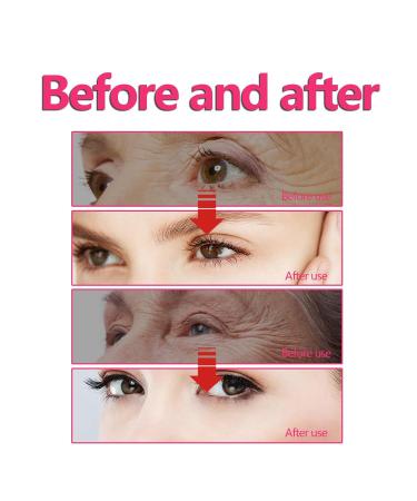 Retinol Eye Stick with Hyaluronic Acid & Vitamin C - Dark Circle & Puffiness Solution | Anti-Aging Under Eye Cream - 3pc Set - Buy Online on GoSupps.com