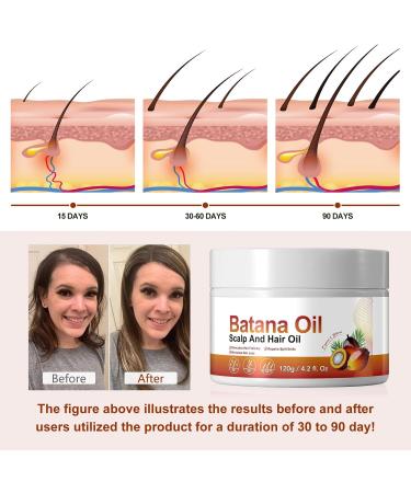 Original Organic Honduras Batana Oil Butter Cream 100% Pure Natural Raw Batana Oil 120g for Hair Growth and Nourishment (120g) - Buy Online on GoSupps.com