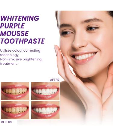 Natural Tooth Whitening Toothpaste | Purple Formula for Yellow Teeth Removal & Sensitive Teeth Protection - Buy Online on GoSupps.com