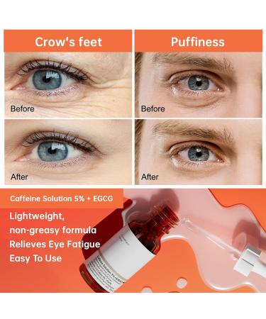 Caffeine Solution 5% + EGCG - Best Under Eye Serum for Puffiness & Pigmentation | 30ml Moisturizing Eye Contour Treatment - International Shipping Available - Buy Online on GoSupps.com