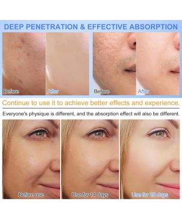 PLOBRT Collagen facial mask collagen Real Deep Mask Deep Collagen Overnight Mask with low molecular weight collagen reduces pores and improves elasticity 34 g x 12 pieces 12 pieces 1er Pack - Buy Online on GoSupps.com