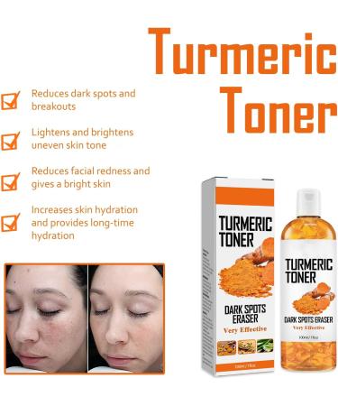 Lotion tonique au curcuma hydratante en profondeur claircissante att nue les taches brunes et les taches de rousseur uniformise le teint resserre les pores r paratrice anti- ge (1pcs) - Buy Online on GoSupps.com