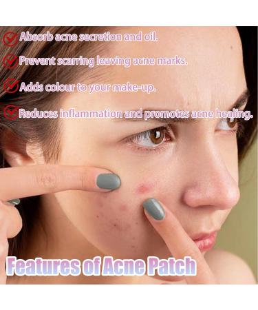 220 Colorful Pimple Patches Acne Absorbing Cover Patch Hydrocolloid Acne Pimple Patches Spot Patches Acne Patches with Tea Tree Oil & Centella for Pimples Blemishes Zits Acne Patches for Face - Buy Online on GoSupps.com