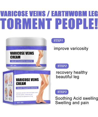 HADAVAKA Vein Care Fading Cream Varicose Vein Cream Leg Swelling Earthworm Leg Care Improve Blood Circulation Relieve Pain of Legs 2 - Buy Online on GoSupps.com