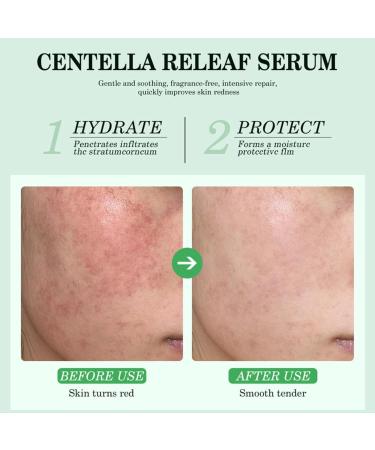 Centella Asiatica Hydrating Serum - Centella Face Serum - Face Serum for Women - Hyaluronic Acid Serum for Face - Calming & Soothing Serum Face - Buy Online on GoSupps.com