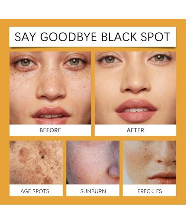 Melanin Correcting Cream Moisturizing Repair Cream Lefun Melanin Cream Dark Spot Corrector Cream Dark Spot Correcting Glow Serum Discoloration Correcting Serum Spot Cream for Women - Buy Online on GoSupps.com