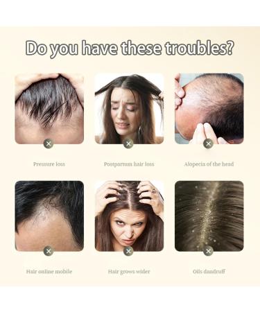 Ginger Plant Extract Anti-Hair Loss Hair Shampoo Ginger Hair Regrowth Shampoo Anti Hair Loss Ginger Shampoo (Color : 1Box) - Buy Online on GoSupps.com