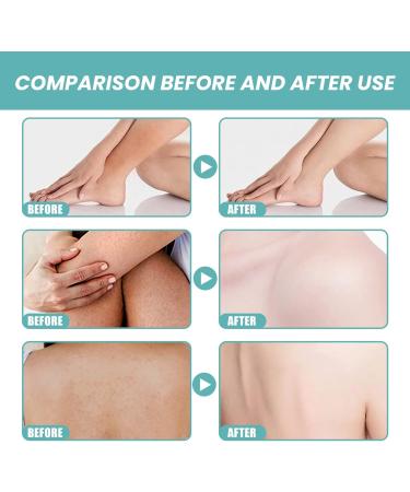 blmcoos Ultramoisturizing bath and shower oil for silky soft skin Skin Soft bath oil softens and cleanses the skin shimmering firming skin for uneven skin tone 3 - Buy Online on GoSupps.com