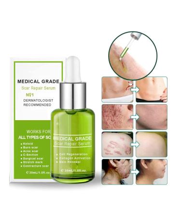 Proregen Medical Grade Scar Removal Spray - Advanced Formula for All Types of Scars (1pcs) - Buy Online on GoSupps.com