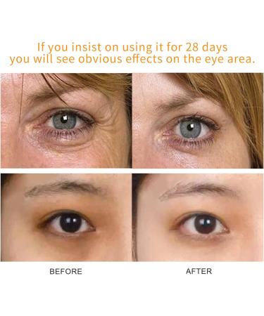 Vitamin C Eye Serum for Anti-Ageing, Wrinkles, Puffy Eyes & Dark Circles - Buy Online on GoSupps.com