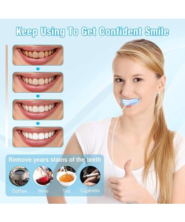 Douceur Teeth Whitening Kit - 5 Whitening Gels, 16 LED Lights - Non-Sensitive, Pain-Free Home & Travel Whitening Solution - Buy Online on GoSupps.com