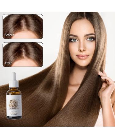 LICHENGTAI Fermented Rice Water Serum 30ml Hair Care Essence Hair Growth Rice Water Thinning Hair Hair Care Oil for Men and Women - Buy Online on GoSupps.com