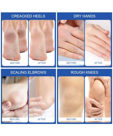 Urea 40% Foot Cream 4.3oz - Pack of 368 | Intensive Moisturizing Treatment - Buy Online on GoSupps.com