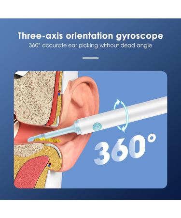 2024 Ear Wax Removal Pro Ear Cleaner with Camera Earwax Removal Kit with Light Electric Ear Wax Removal Tool Ear Cleaner. (White) - Buy Online on GoSupps.com