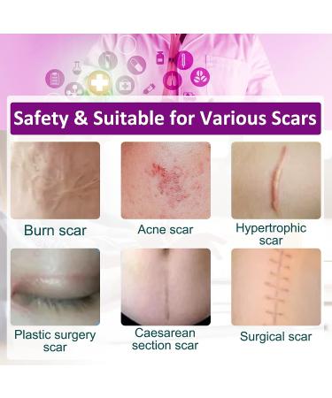 Clear Silicone Scar Sheets - Medical Grade Invisible Scar Removal Tape (1.6 x 60 Roll) for Surgical Scars, C-Section, Breast, Keloid, Acne - 1.5M - Buy Online on GoSupps.com