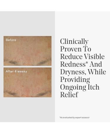 Murad Eczema Control Daily Defense Colloidal Oatmeal Cream - Redness and Itch Relief Moisturizer - Buy Online on GoSupps.com