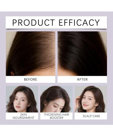 Huile naturelle pour cheveux au romarin - S rum volume et soin pour le cuir chevelu et cheveux secs et ab m s - Huile paississante pour tous les types de cheveux pour femmes et hommes - Renforce et 8 pi ces. - Buy Online on GoSupps.com