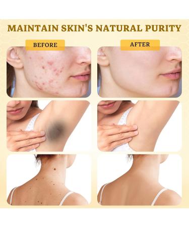 2PCS Bee Venom Face & Body Moisturizer, Lightweight Hydration, Smooth & Soft Skin Feel, 60g x 2 - Buy Online on GoSupps.com