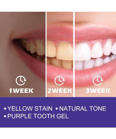 Advanced Teeth Whitening Toothpaste - Deep Cleaning Anti-Stain Formula for Yellow Teeth Freshens Breath & Relieves Gum Discomfort(1PCS) 1 Count (Pack of 1) - Buy Online on GoSupps.com