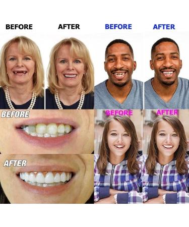 Perfect Smile Dentures Pebbles - Cosmetic Veneers & Temporary Prostheses for Men & Women | 6 Pairs of Reusable Tooth Whitener - Buy Online on GoSupps.com