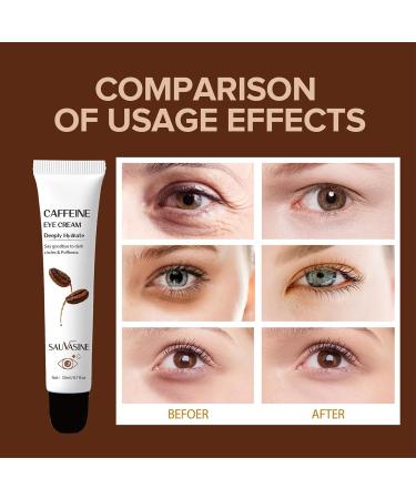 Caffeine Eye Cream Caffeine Staying Up All Night Firming Eye Cream 20g Caffeine Anti-Wrinkle Firming Lightening Fine Lines Retinol Anti-Wrinkle Eye Cream For Dark Circles And Bags Under eyes - Buy Online on GoSupps.com