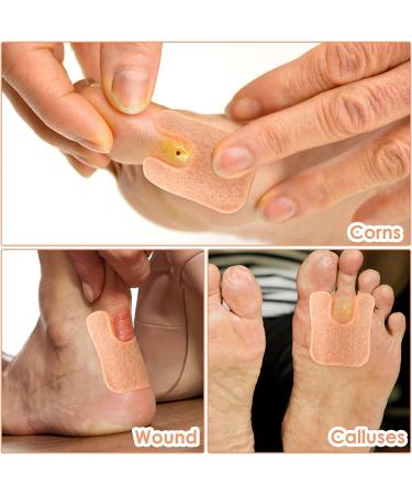 20 PCS U-Shaped Felt Callus Pads - Metatarsal & Forefoot Cushion for Foot Pain Relief & Protection from Rubbing - Self-Adhesive Foot Care - Buy Online on GoSupps.com