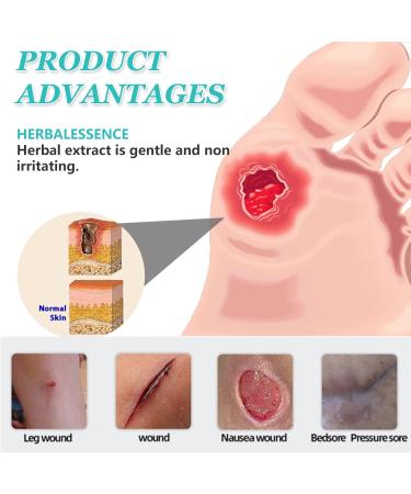 Bed Sore Cream Skin Care Cream Gentle Daily Care for Bed Sores Provides Soothing Support for Home & Nursing Use 0.71Oz - Buy Online on GoSupps.com