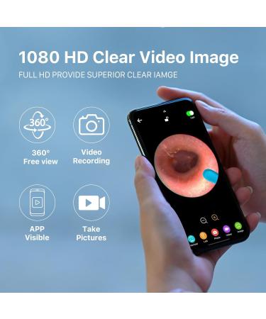 1080P HD Ear Wax Removal Tool Camera with 6 Spoons | Otoscope Earwax Removal Kit for iOS Android | 6 LED Light Ear Camera Included - Buy Online on GoSupps.com