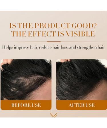 Natural Hair Regrowth - Hair Loss Treatment Volume & Root Booster 30ml Moisturizing Hair Treatment for Stronger Hair Plus Anloximt - Buy Online on GoSupps.com
