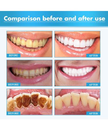 Herbal Brightening Oral Repair Foam Herbal Super Whitening Teeth Teeth Whitening Foam Mousse Jorondy Teeth Mouthwash Teeth Whitening Foam Teeth Whitening Mouthwash - Buy Online on GoSupps.com