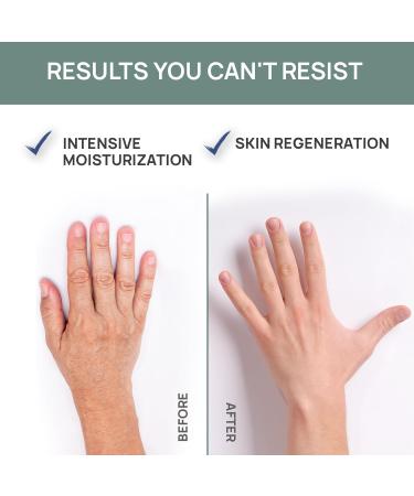 Vis Plantis Hand Cream & Nail Cream for Women 135ml | Snail Mucus Serum Olive Oil & Urea | Natural Hand & Nail Care Cosmetics - Buy Online on GoSupps.com