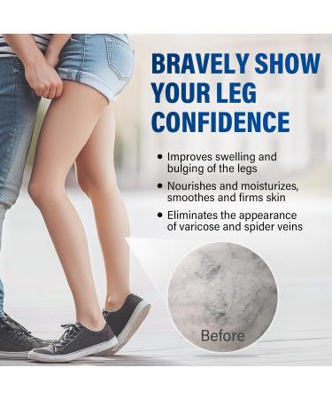 Josera Varicose Veins Treatment for Legs Varicose Veins Soothing Relief Cream to Improve Circulation Reduce Swelling & Discomfort - Buy Online on GoSupps.com
