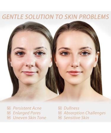 Kojic Acid and Turmeric Pads Turmeric Kojic Acid Pads Exfoliating Face Turmeric Kojic Pads Turmeric Kojic Cleansing Pads for Dark Spots Dull Skin Helps Balance Skin Oil and Water - Buy Online on GoSupps.com
