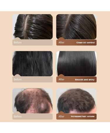 Silvercell Castor Oil Conditioner - Hair Growth & Moisturizing Shampoo for Damaged Hair | Thickening Oil Control 16.91 fl. oz - Buy Online on GoSupps.com