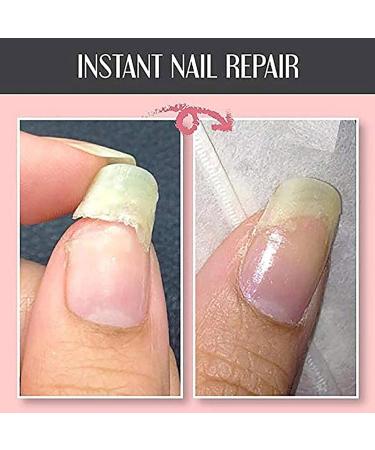 Nail Repair Protection Gel Mottled Nail Treatment Repair Gel 10ml Instant Nail Repair Protect Gel Nail Strengthener Gel Broken Nail Repair Gel Polish - Buy Online on GoSupps.com