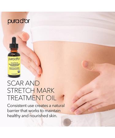PURA DOR Organic Scar & Stretch Mark Treatment Oil | 1oz For Skin - Rosehip, Wheat Germ, Argan, Tamanu, Carrot, Rosemary, Lavender, Geranium, Patchouli, Sage - Buy Online on GoSupps.com