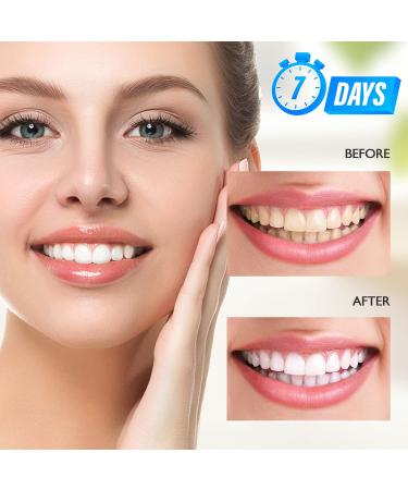 Mitbuty Tooth Whitening Strips with Natural Coconut Oil - 42 Non-Slip Treatments for Professional Teeth Whitening - Safe & Effective - Buy Online on GoSupps.com
