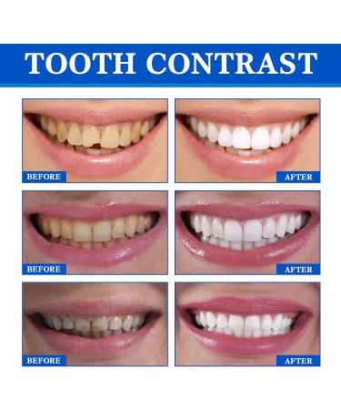 2pcs 10ml Teeth Whitening Essence | Remove Plaque & Stains | Temporary Teeth Whitening Serum for White Teeth - Fast International Shipping - Buy Online on GoSupps.com