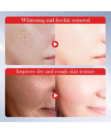  Mnozreo Kojic Acid Cream Shiny Skin Cream for Face Shiny for Dark Spots and Melanin Anti-Aging for Women 30g 1 Piece - Buy Online on GoSupps.com