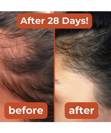 Lenoria Pumpkin Seed Oil Strengthening For Hair Growth And Skin Elasticity For Men And Women2pcs - Buy Online on GoSupps.com