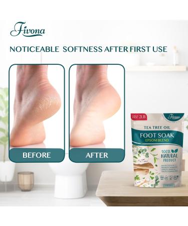 Foot Soak Epsom Salt with Tea Tree Oil 2 LB - Epsom Salt with Essential Oils for Healthy Toenails Soothing Relief Odor Control Callus Softening - Pedicure Therapy for Soft Rejuvenated Feet - Buy Online on GoSupps.com