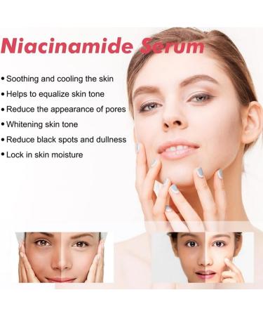 Nicotinamide Facial Essence Female Facial Brightening Essence Moisturizing and Desalting Dull Essence Pore Constrictor Black spot remover 35ml Facial anti-Wrinkle Essence - Buy Online on GoSupps.com