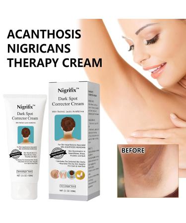 Nigrifix Acanthosis Nigricans Therapy Cream Dark Spot Remover For Body Dark Spot Corrector Cream - Underarm Neck Armpit Knees Elbows Private Areas Intimate Areas - Upgraded Formula - 2.1Fl Oz - Buy Online on GoSupps.com