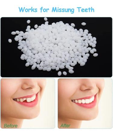 Flipped Warm 2 Pairs False Teeth Veneers | Cosmetic Tooth Covers & Artificial Dentures - Shop Now for White Provisional Teeth - Buy Online on GoSupps.com